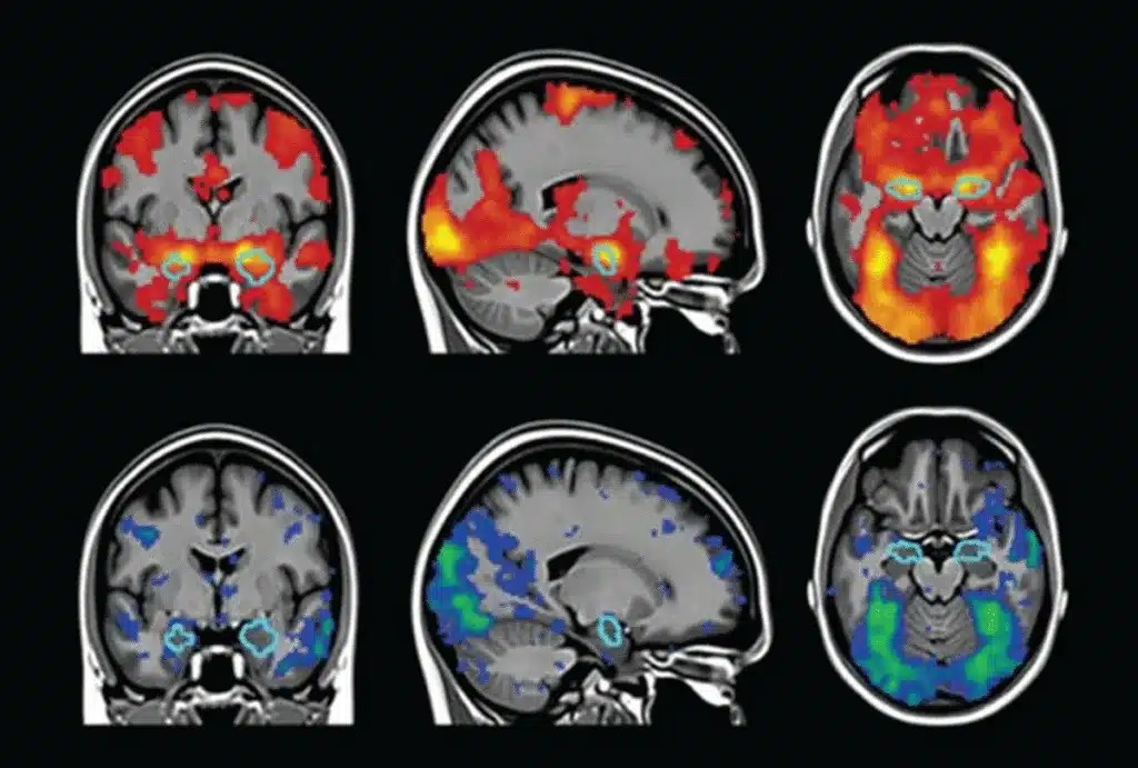 brain-scans